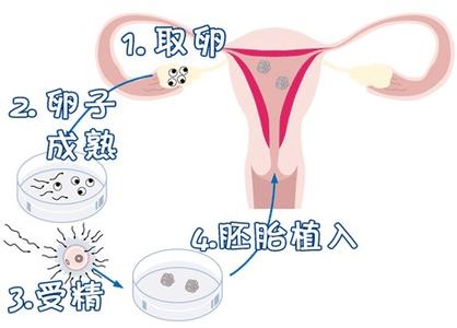 代生儿子机构